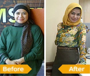 Lomba turun berat badan online - Kompetisi penurunan berat badan - Tantangan turun berat badan - Program diet kompetitif - Kontes penurunan berat badan